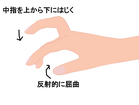 病的反射・ホフマンの図