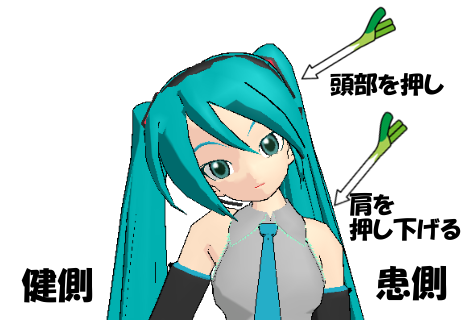 初音ミクのショルダーデプレッションテストMMD